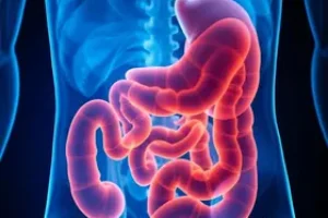 câncer colorretal metastático